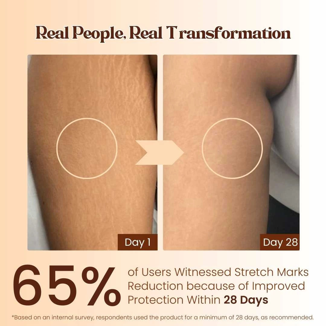 Natural Stretch Marks Cream 50g