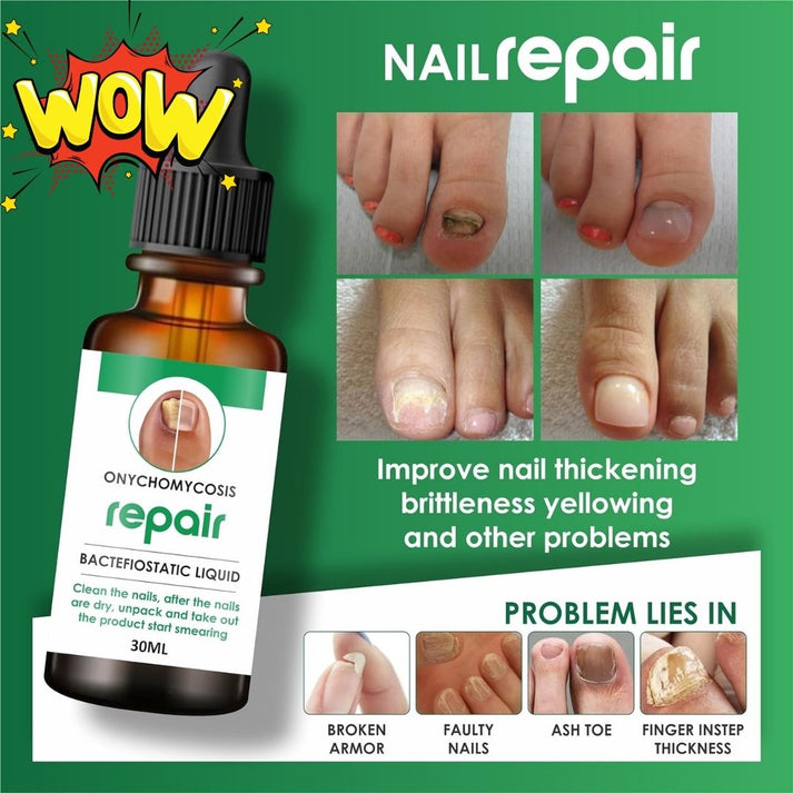 Nails Strong Growth And Repair Oil 30 ML ( Pack Of 2)