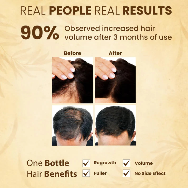Jamalgota Hair Growth Oil Each 30ml Pack of 2