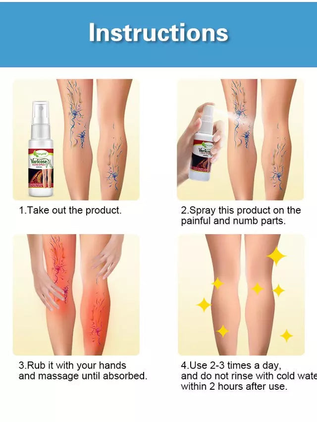 Vein Healing Varicose Veins Treatment Spray 50ml (Pack Of 2)