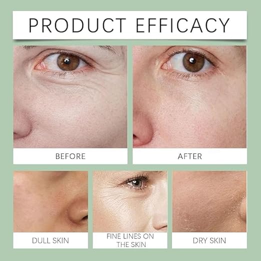 Anti-Wrinkle Multi-purpose Cream
