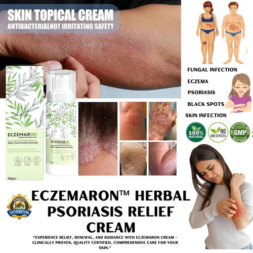 Eczemarone Anti Fungal Cream